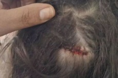  Menina de 7 anos é ferida por bala perdida enquanto dormia em casa 
