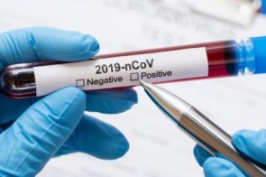 Familiares de casal que testou positivo para coronavírus em Dourados são monitorados