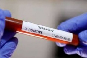 Dourados registra sétimo caso confirmado do novo coronavírus