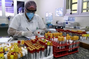 Aumento da demanda faz governo levar testes de coronavírus para análise em São Paulo