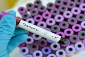 Mato Grosso do Sul tem 39 mortes por coronavírus e 4.274 confirmados