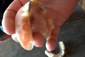 Idoso morre de covid e dentes de ouro de R$ 12 mil são furtados de prótese