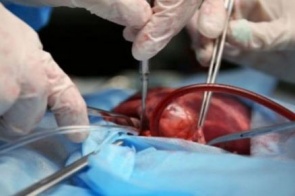 Fila do transplante de órgãos tem 428 pessoas em MS