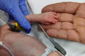 Mais de 60 crianças aguardam cirurgia cardíaca e MP investiga fila no SUS em MS