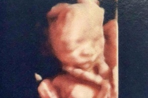 Grávida, Bella Falconi mostra ultrassom do bebê