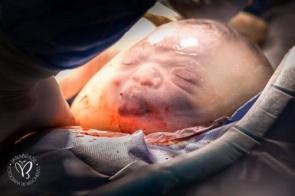 'Ganhei um presente embalado', diz mãe de bebê que nasceu dentro da bolsa amniótica no ES