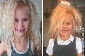 Menina de 7 anos tem cabelo 'impenteável' por causa de condição raríssima